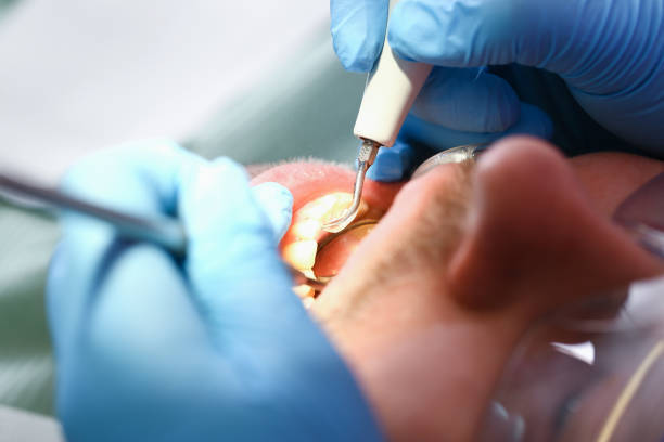 Best Cracked Tooth Emergency Dentist  in Byron, GA